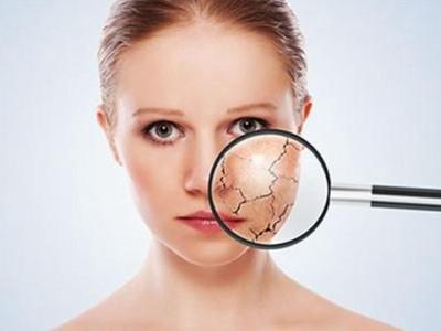 當皮膚出現干裂的情況應該如何處理