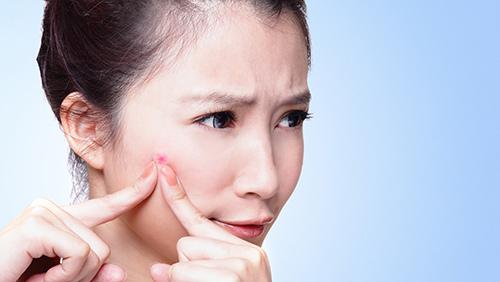 臉上長粉刺的原因為什么下巴處會起粉刺