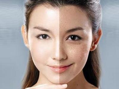 臉上長斑要怎樣可以去除臉上的斑點