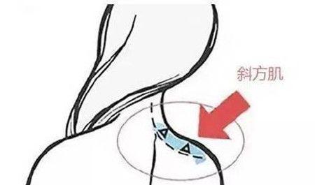 斜方肌可以通過按摩的方式消除嗎-易網健康<a href=http://www.logojc.com/jkys/ target=_blank class=infotextkey>養生</a>網 斜方肌可以通過按摩的方式消除嗎