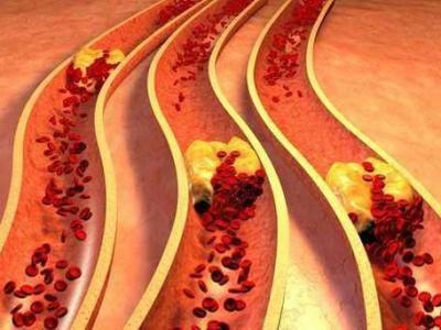 血脈通膠囊會(huì)對(duì)身體產(chǎn)生哪些副作用