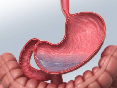 經(jīng)常吃哪些食物容易導(dǎo)致腸胃中長石頭