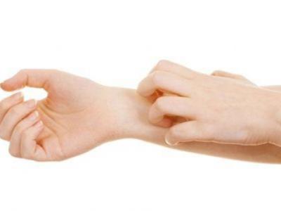 皮膚瘙癢的時(shí)候哪些藥膏止癢比較快