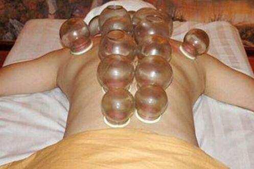 拔火罐的頻率控制在幾天拔一次最好