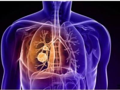 肺部功能的監測分別監測哪些方面