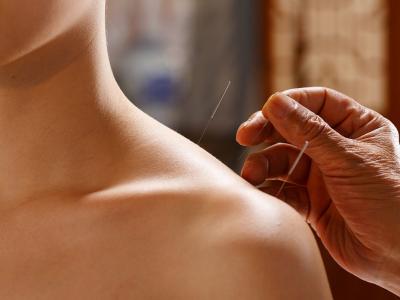 一天之內(nèi)適合針灸的時間段是什么時候