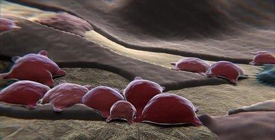 在不同的年齡段骨骼密度健康范圍