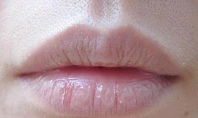 嘴唇經(jīng)常起皮常見因素可能與以下三種情況有關(guān)