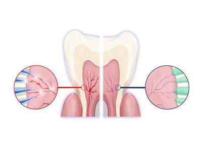 做好這六件事可以很好的預防牙齒敏感-易網健康<a href=http://www.logojc.com/jkys/ target=_blank class=infotextkey>養生</a>網 做好這六件事可以很好的預防牙齒敏感
