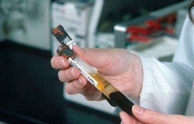 身體檢查性激素六項(xiàng)的標(biāo)準(zhǔn)值是多少