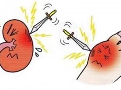 身體沒有出現(xiàn)這五個表現(xiàn)說明你腎臟不錯