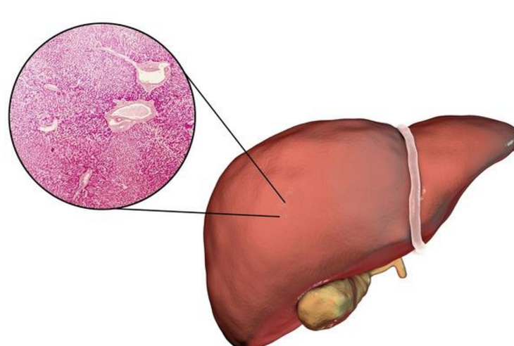 肝臟不好的人早晨起床會有這六個癥狀-易網<a href=http://www.logojc.com/ target=_blank class=infotextkey>健康養生</a>網 肝臟不好的人早晨起床會有這六個癥狀