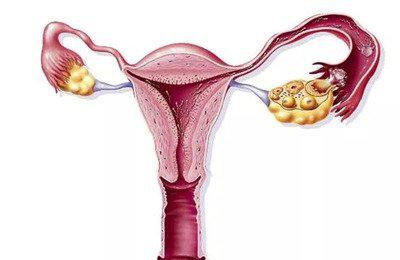 導(dǎo)致卵巢提前走向衰老的原因有哪些