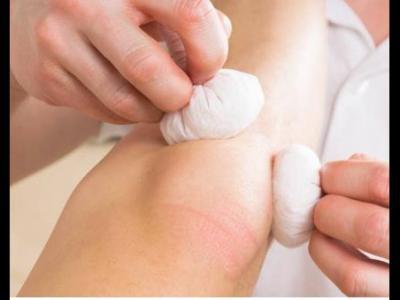 類風濕關節痛醫院都檢查哪些項目