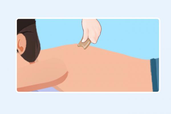 三伏天刮痧拔罐的好處和壞處 拔罐和刮痧哪個去濕氣