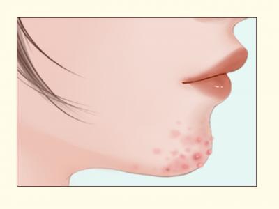 三伏天里該如何保養皮膚 三伏天護膚小妙招