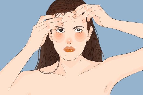 上火長(zhǎng)痘痘怎么調(diào)理去火 上火冒痘吃什么降火