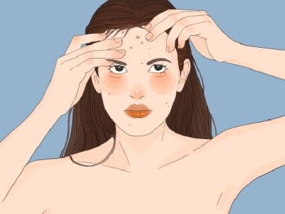 上火長痘痘怎么調(diào)理去火 上火冒痘吃什么降火