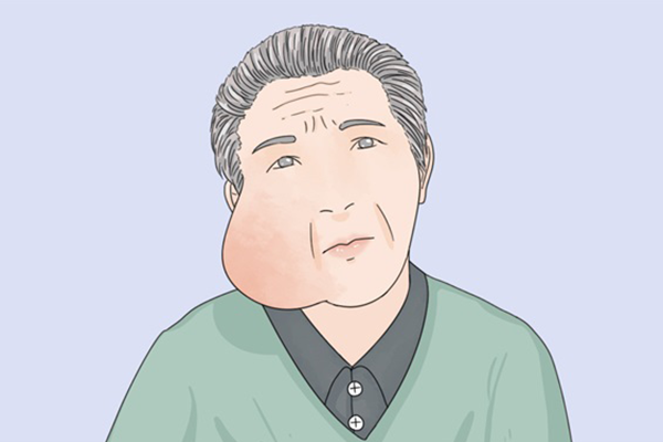 消耗性疾病有哪些