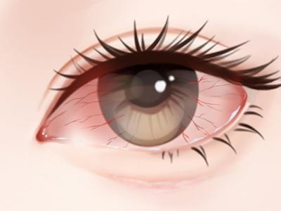 眼睛干澀發(fā)紅