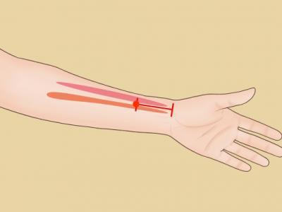 內(nèi)關(guān)穴按摩的好處 按摩內(nèi)關(guān)穴的正確方法