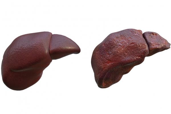 肝硬化能吃羊肉嗎