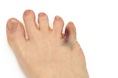 怎樣判斷是不是糖尿病足 三大糖尿病爛腳前兆