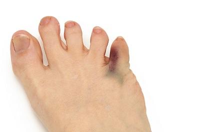 糖尿病足治療最好的醫院 盤點糖尿病足十大醫院