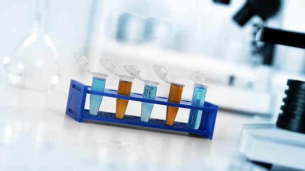 性激素六項檢查注意事項有哪些 性激素六項的參考范圍是什么