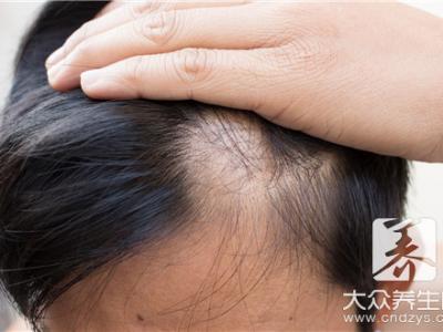 縱欲過度掉頭發還長嗎