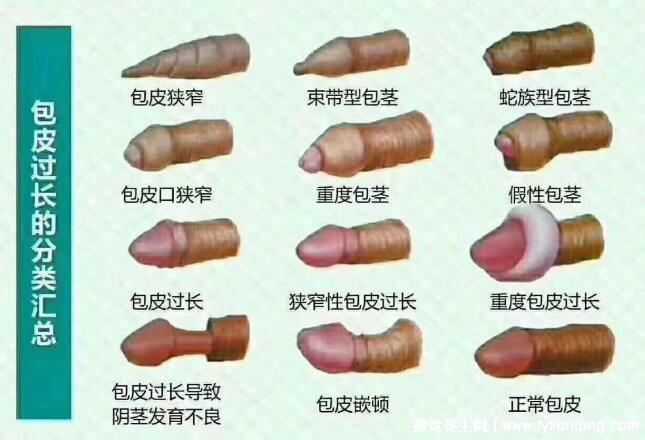 老公割包之后好像沒有那么厲害了，因為更敏感了(5個原因)