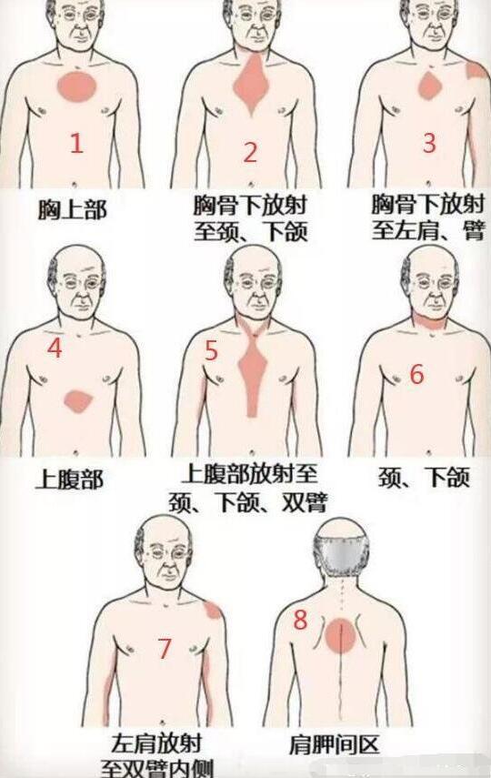 女性后背疼警惕四種病，腰部周圍痛小心婦科病(疼痛位置圖解)