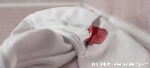 真實宮頸癌的早期出血圖片，接觸性出血是最明顯癥狀(女性必看)