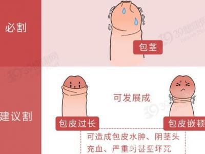 成年男子割包好處和壞處，8種情況必須割(附割包照片真實)