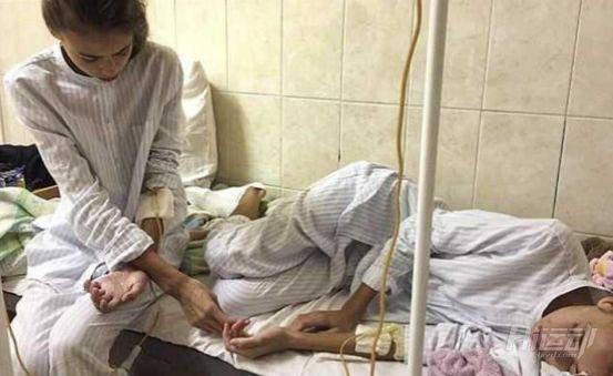 為成為模特這對雙胞胎做了這件事，患上厭食癥還成了“老奶奶”