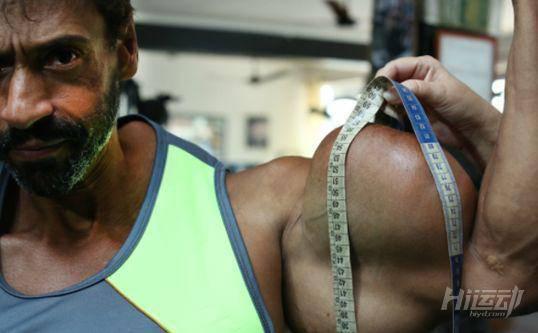 為追求更大的肌肉男子不惜代價，注射燃油手臂足有60cm粗