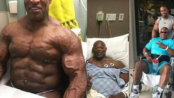 頭頂8個奧林匹亞冠軍，“祖師爺”身上已經打滿鋼釘！