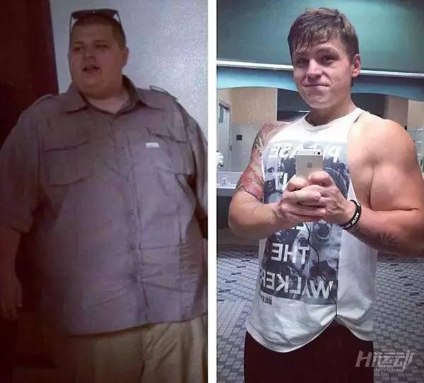 胖子成功減肥200斤，皮膚松弛也坦然面對！