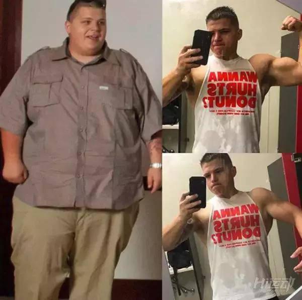 胖子成功減肥200斤，皮膚松弛也坦然面對！