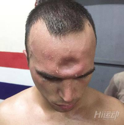 為什么終止比賽？我還沒打夠呢！