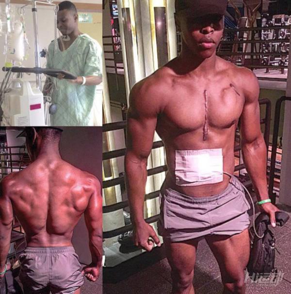 每天先充電才能活！小伙靠人工心臟續命，依然堅持健身