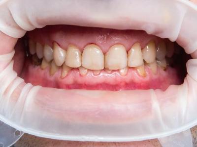 腰部肥胖的人該如何飲食減肥 腰部肥胖的人該怎么飲食減肥