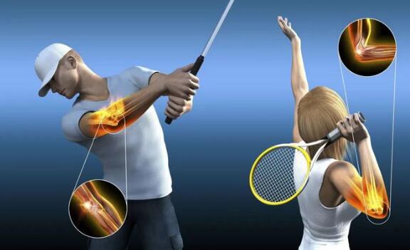 網(wǎng)球肘最怕三個動作，反手拍球/手腕彎曲/提重物/做家務(wù)