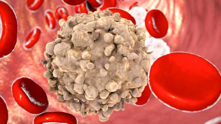 小產后能減肥嗎?小產后的注意事項有什么?-易網健康<a href=http://www.logojc.com/jkys/ target=_blank class=infotextkey>養生</a>網 小產后能減肥嗎?小產后的注意事項有什么?