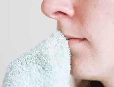  嘟嘴賣萌?麻煩先把唇部保養好再說 