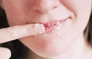  嘟嘴賣萌?麻煩先把唇部保養好再說 