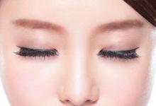 面部整容讓人更漂亮 但要謹記這些風險