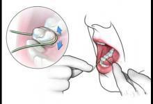 健康公開課：天天塞牙？使用牙線的“三步走”戰(zhàn)略送給你