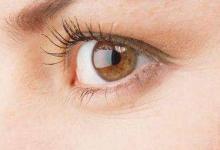 3大原因?qū)е卖~尾紋？3種醫(yī)美方式幫你去除