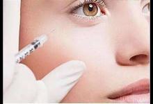 玻尿酸豐臥蠶有哪些優(yōu)勢和副作用？